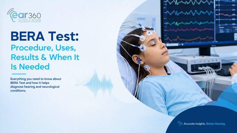 BERA Test: Procedure, Uses, Results & When It Is Needed | Resonnocare