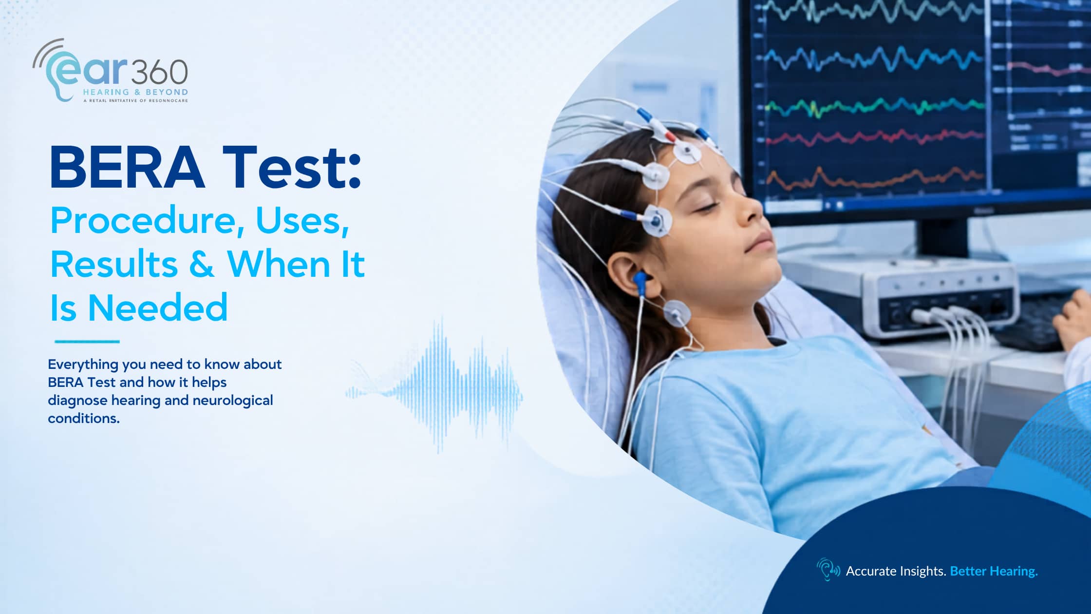 BERA Test Procedure, Uses, Results & When It Is Needed